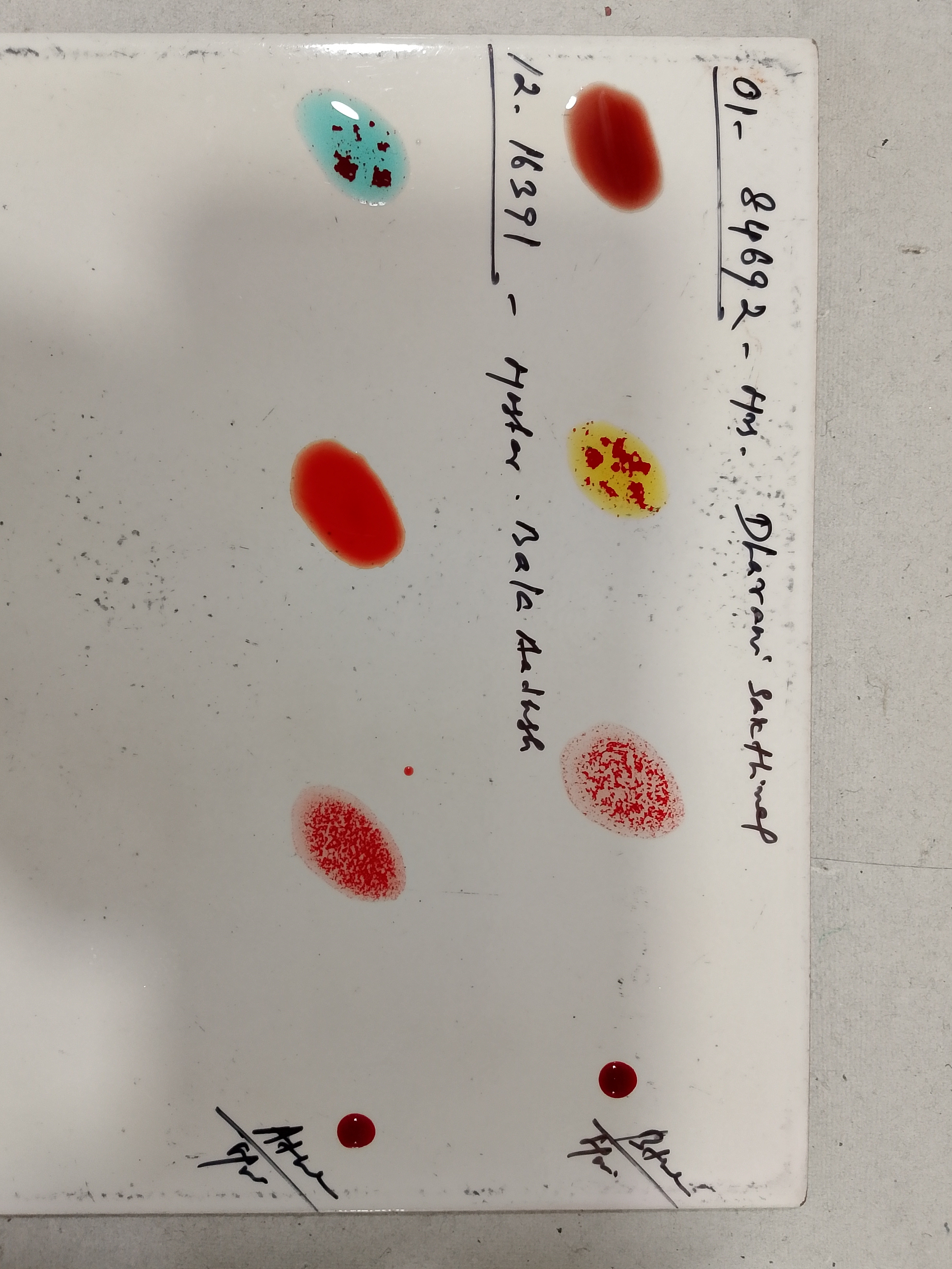 biolinelab.org - /SLIMS/Test_Images/03.11.25_01084692_000428/